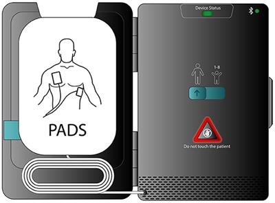 Estimation of Health and Economic Benefits of a Small Automatic External Defibrillator for Rapid Treatment of Sudden Cardiac Arrest (SMART): A Cost-Effectiveness Analysis